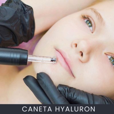 Caneta Hyaluron Curso Online